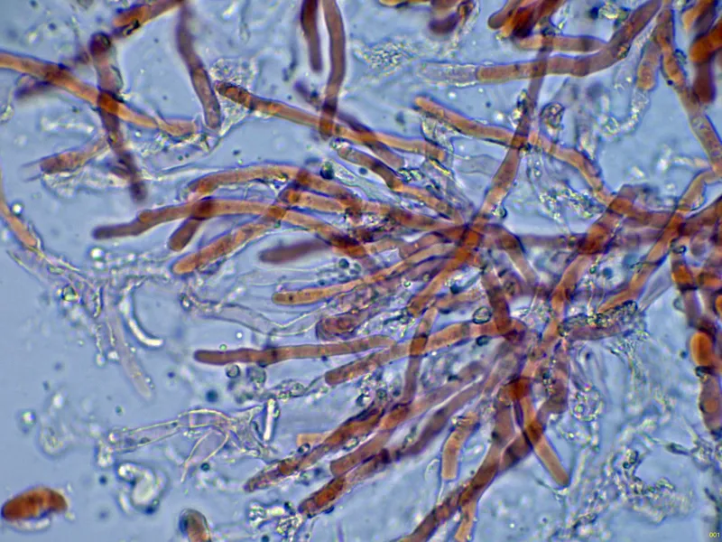 Ceriporia bresadolae 10 - Hifas terminales-001
